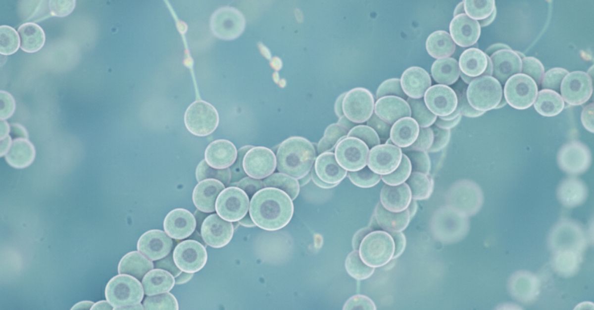 Endometrioma ovariano e Fertilização in Vitro: quando operar, riscos, impacto na reserva ovariana e como a FIV contorna o problema 3 Endometrioma ovariano e Fertilização in Vitro: quando operar, riscos, impacto na reserva ovariana e como a FIV contorna o problema