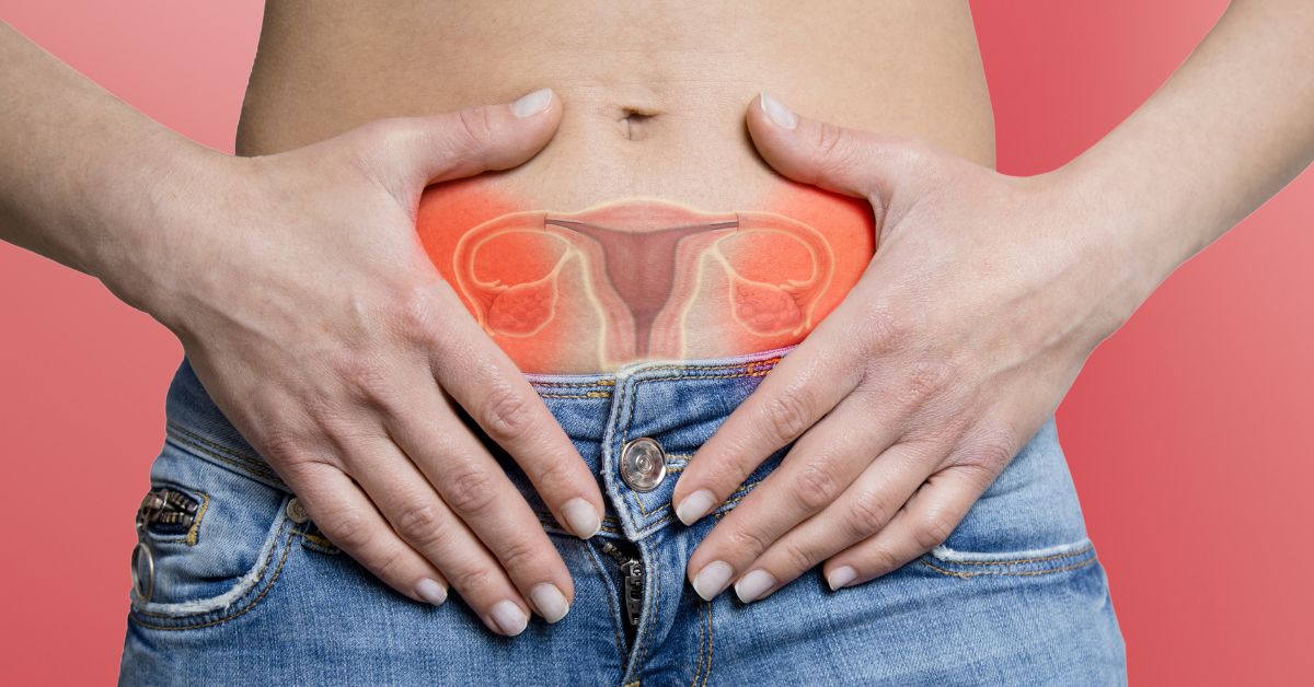 Endometrioma ovariano: alcoolização x cirurgia—indicações, vantagens, riscos e efeitos na fertilidade. Entenda quando cada opção é melhor 1 Endometrioma ovariano: alcoolização x cirurgia—indicações, vantagens, riscos e efeitos na fertilidade. Entenda quando cada opção é melhor