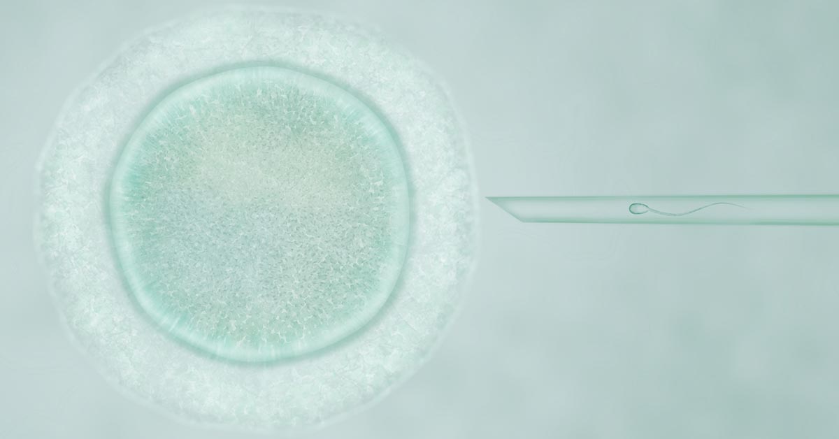 Inseminação artificial (IIU): o que é, como funciona e indicações 2 Inseminação artificial (IIU): o que é, como funciona e indicações